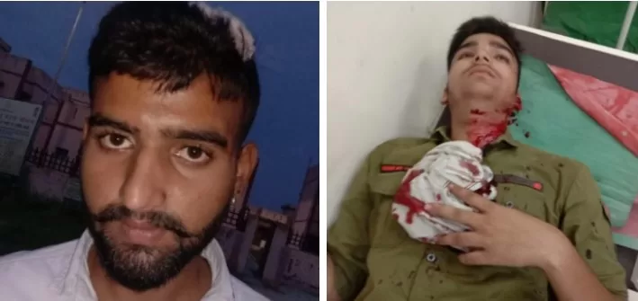 पुलिस से बेखौफ सशस्त्र दंबगों ने दो छात्रों को पीट पीट कर किया अधमरा, मेरठ रैफर, नगर की पॉश कालोनीं श्रीनगर, शिवपुरी सहित अन्य में है मनचलों व दंबंगों का आंतक, पुलिस बनी मूकदर्शक